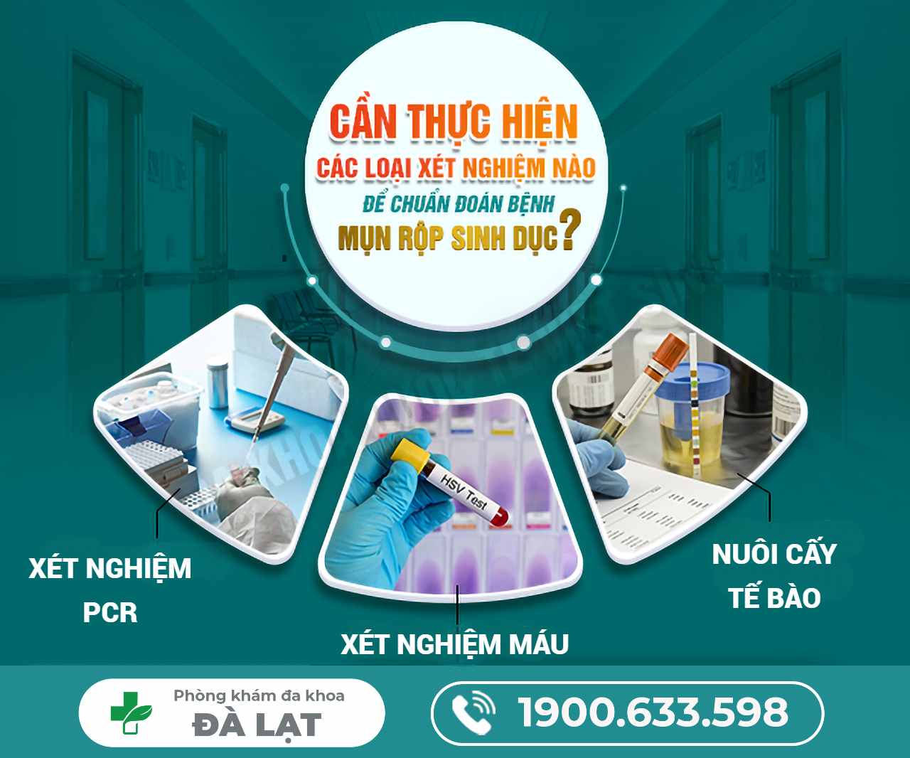 Hình ảnh minh họa